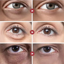 Rolon 5 em 1 Ultra Rejuvenescedor Luteína Inova® PAGUE 1 LEVE 3 (com entrega relâmpago ⚡)