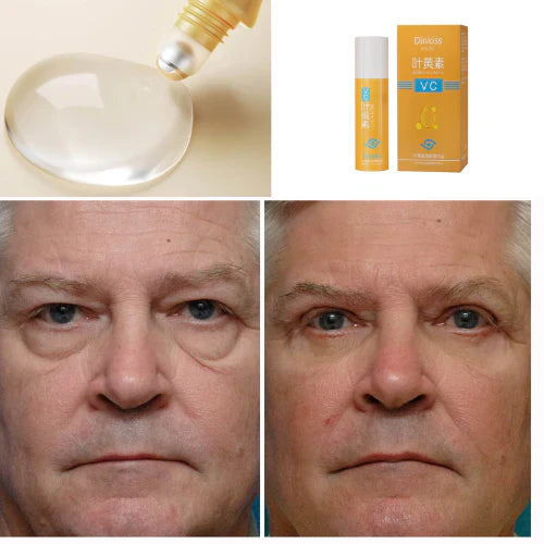 Rolon 5 em 1 Ultra Rejuvenescedor Luteína Inova® PAGUE 1 LEVE 4 (com entrega relâmpago ⚡)