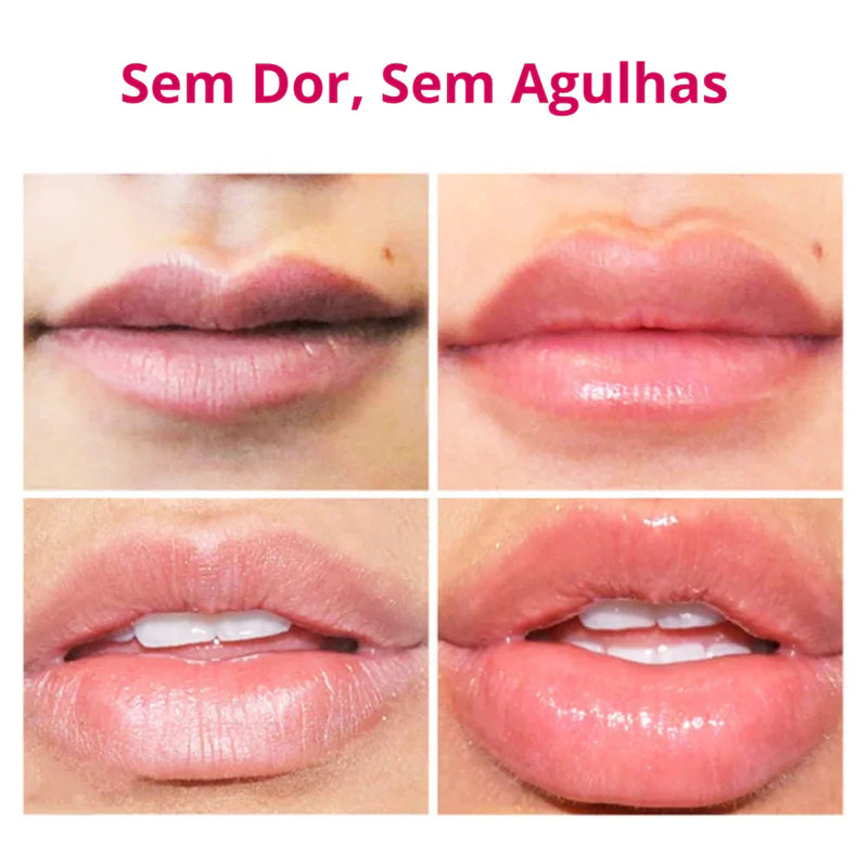 Plumping | Gloss Com Ácido Hialurônico - Aumenta o Volume dos Lábios