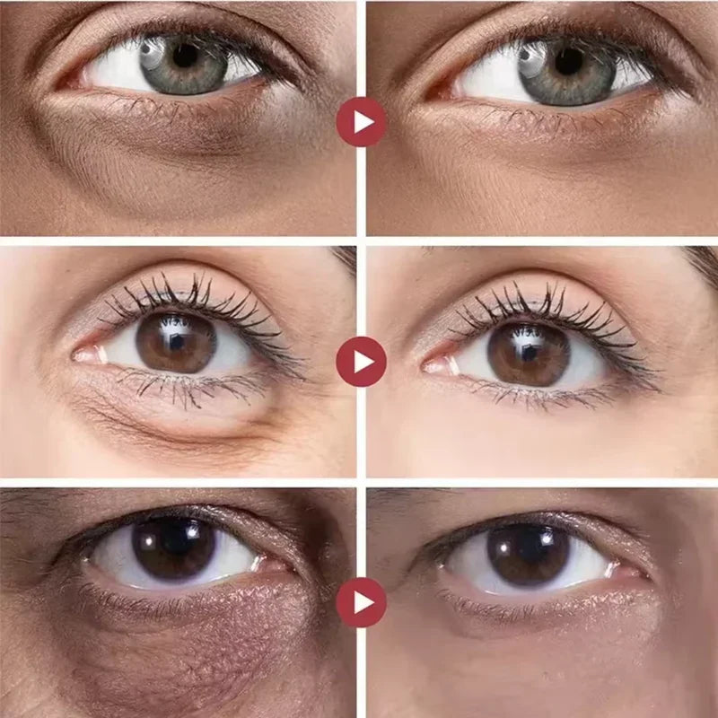 Rolon 5 em 1 Ultra Rejuvenescedor Luteína Inova® PAGUE 1 LEVE 4 (com entrega relâmpago ⚡)